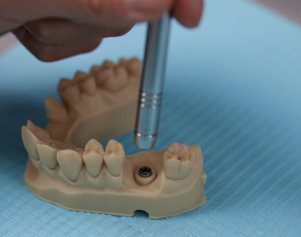 Formlabs 3D-Druck-Zahnmaterial Formlabs 3D Printing Dental Material